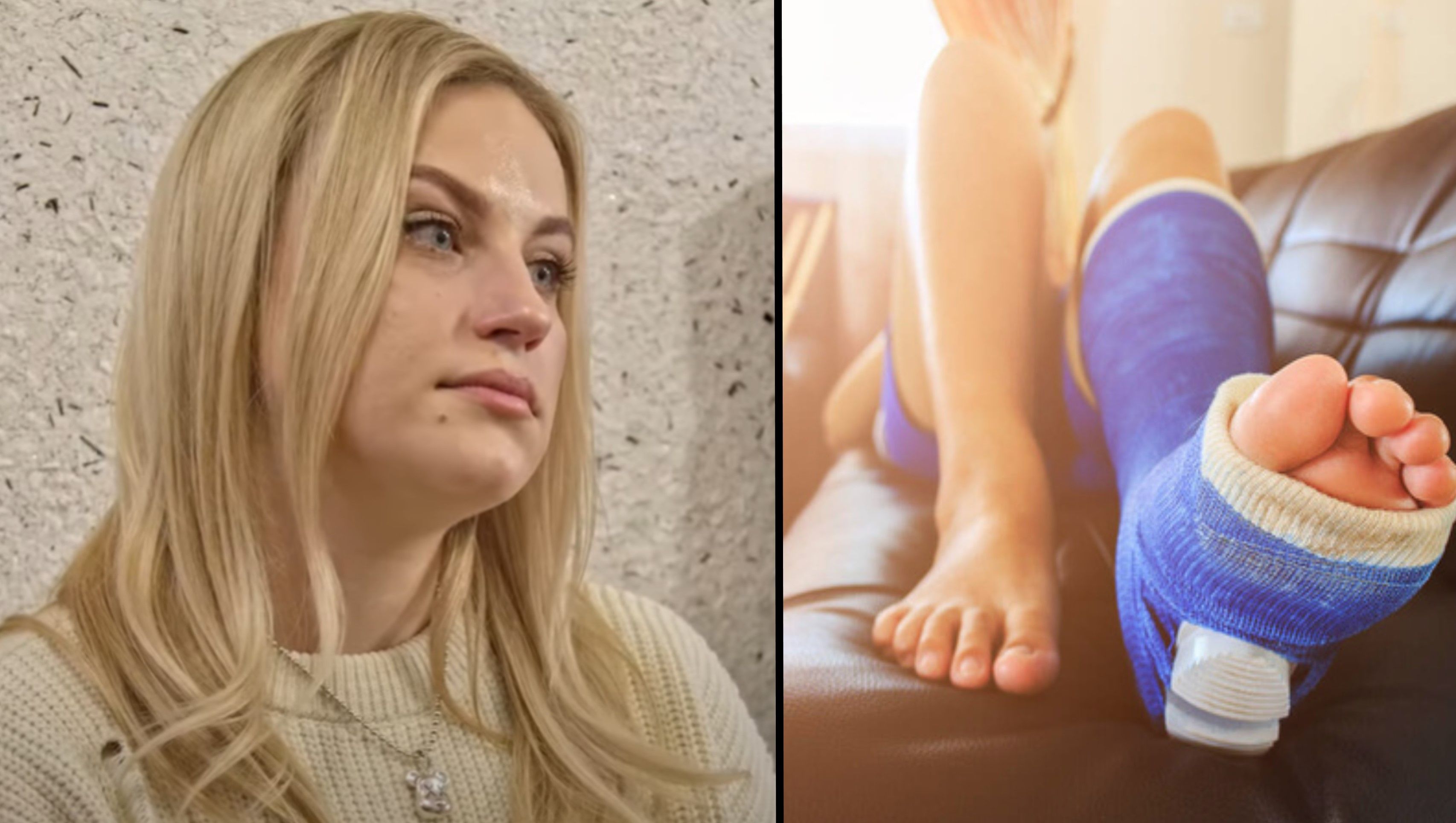 Муж сломал ногу жене, чтобы уехать из страны Муж сломал ногу жене, чтобы уехать из страны