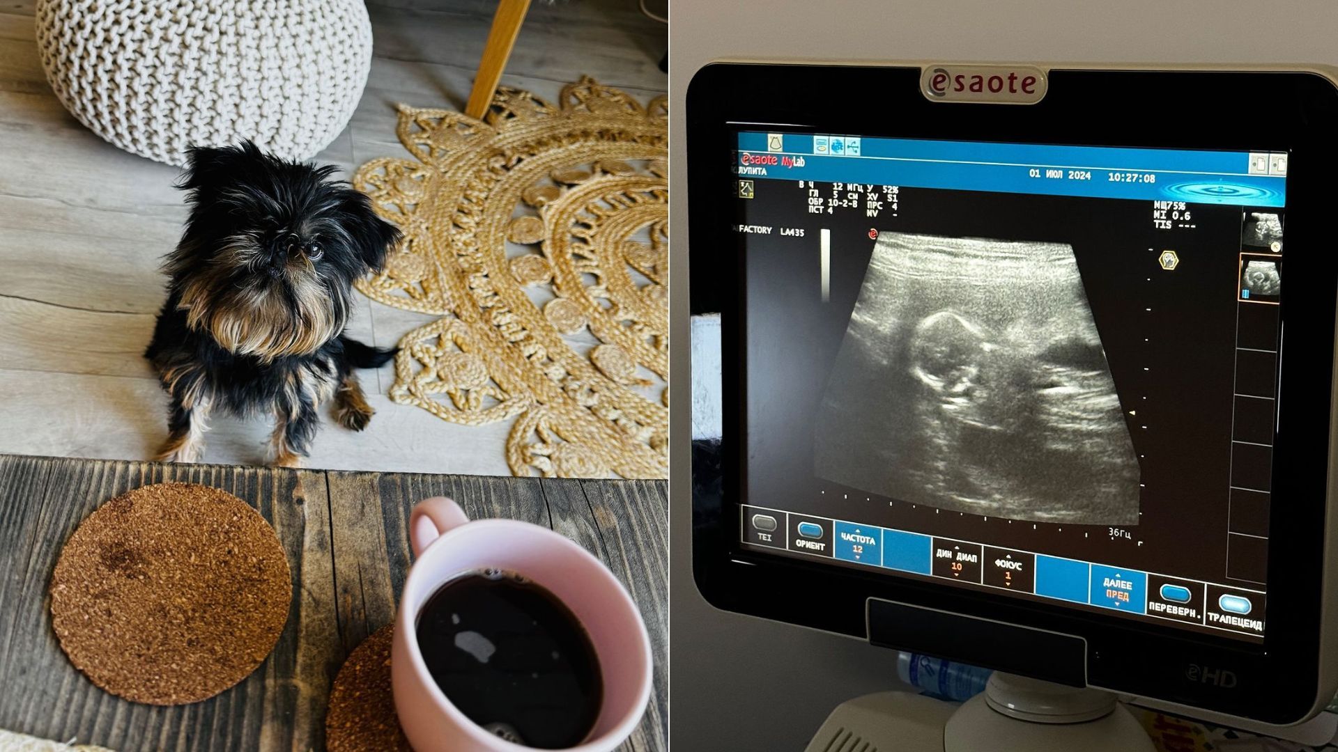 Моя крихітка вагітна, – Ектор Хіменес-Браво здивував звісткою про поповнення в родині - Show Моя крихітка вагітна, – Ектор Хіменес-Браво здивував звісткою про поповнення в родині - Show